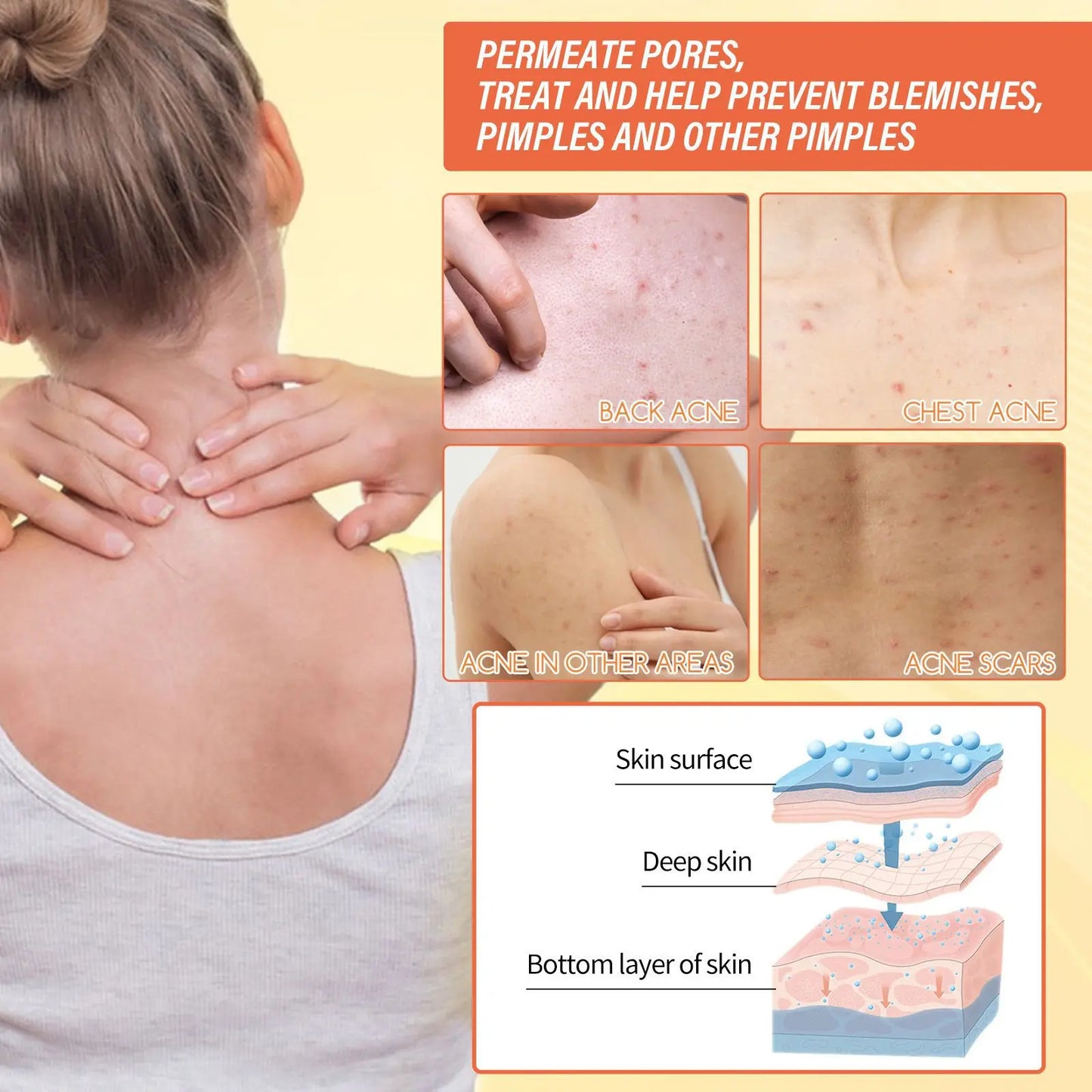 Jaysuing 100g Kojic Acid Skin Lightening Soap Bleaching Exfoliating Dilute Acne Pimple Dark Spot Remover Brightening Body Soap