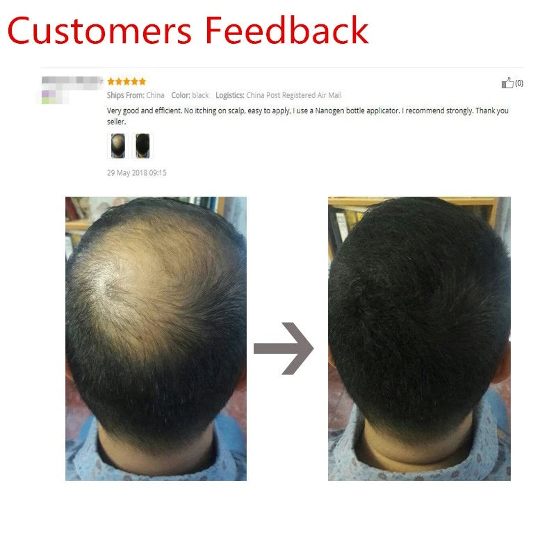 Sevich 10 Colors Hair Fibers Keratin 25g Hair Building Fibers Thickening Spray Hair Loss Products Instant Regrowth Powders