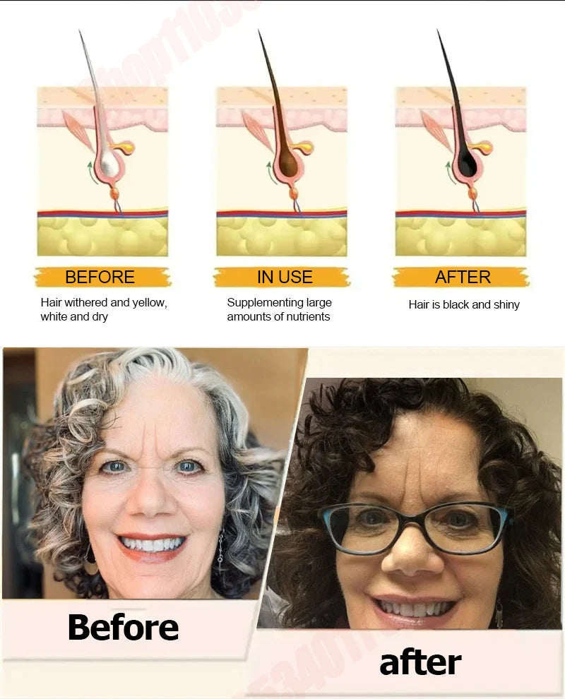 Eғғᴇᴄᴛɪᴠᴇʟʏ ʀᴇᴘᴀɪʀ ɢʀᴀʏ ʜᴀɪʀ ᴀɴᴅ ʀᴇsᴛᴏʀᴇ ᴏʀɪɢɪɴᴀʟ ʜᴀɪʀ ᴄᴏʟᴏʀ