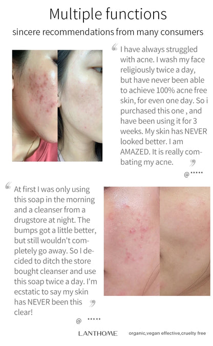 Turmeric Soap For Dark Spot Deep Cleaning Whitening Smoothing Skin Facial Body Natural Handmade Soap For Men and Women