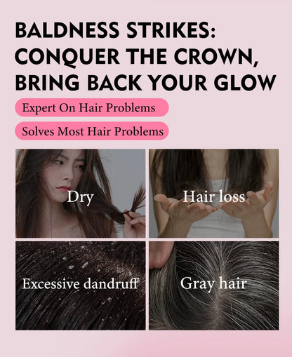 Natural 100% Pure Batana Oil For Hair Growth Butter Hair Mask Traction Alopecia Anti Hair Loss Baldness Treatment For Men Women