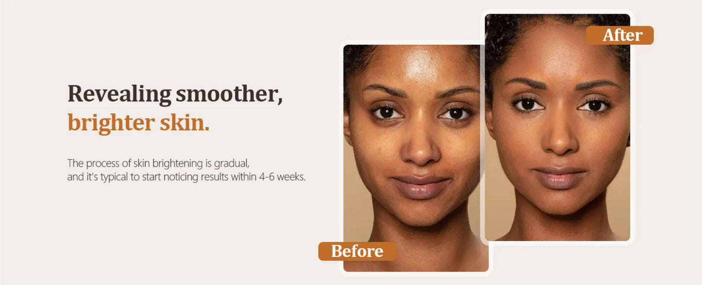 Turmeric Kojic Acid Glow Soap Dark Spot Acne Removal Even Skin Tone Mositen Smooth Skin Deep Cleansing Handmade Soap