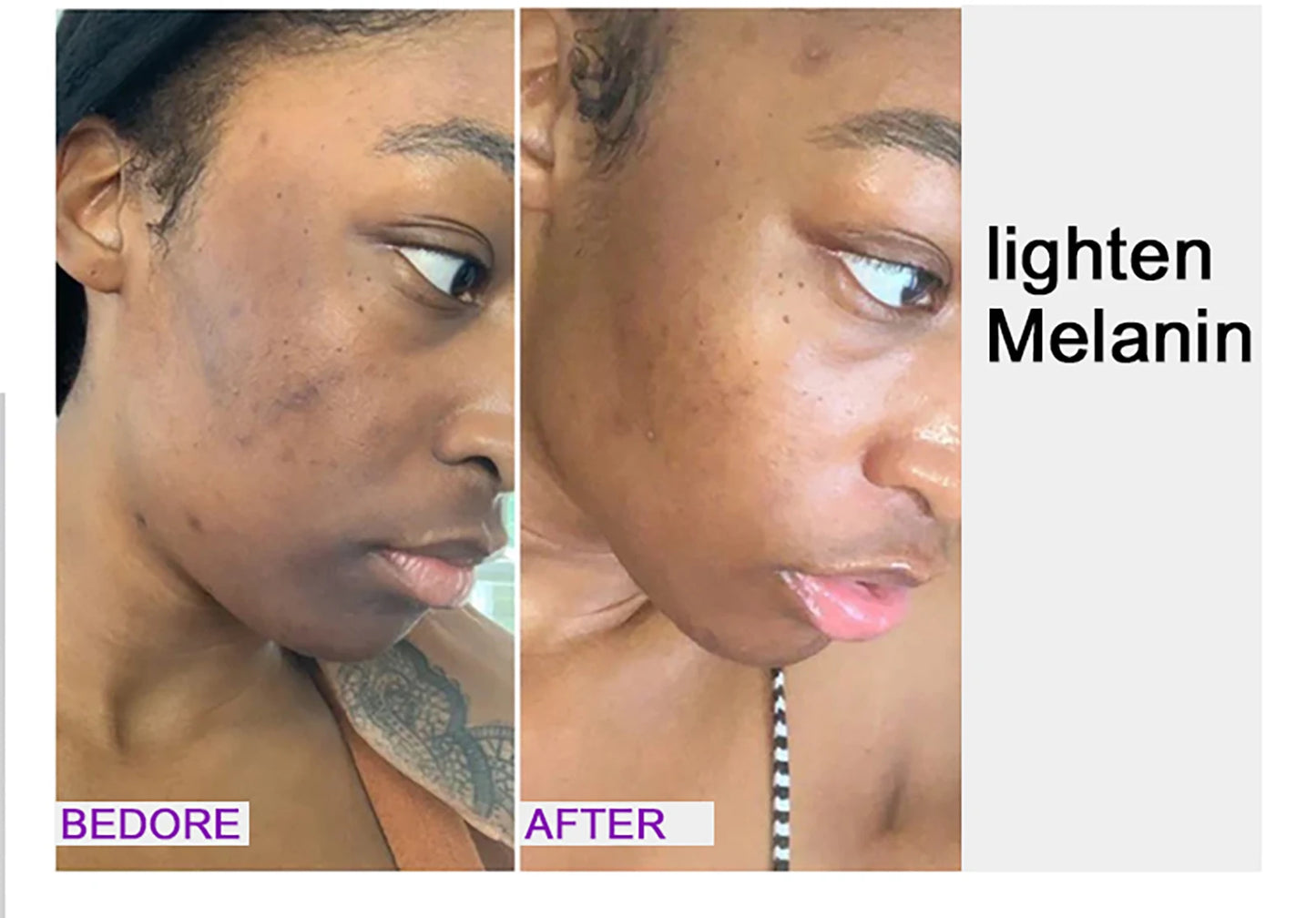 AILKE Premium Skin Lightening Cream - Dark Spot Corrector for Uneven Skin Tone - Face, Body, Underarm, Knees, Elbows, Knuckle