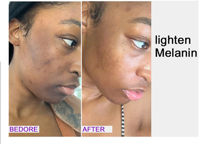 AILKE Premium Skin Lightening Cream - Dark Spot Corrector for Uneven Skin Tone - Face, Body, Underarm, Knees, Elbows, Knuckle