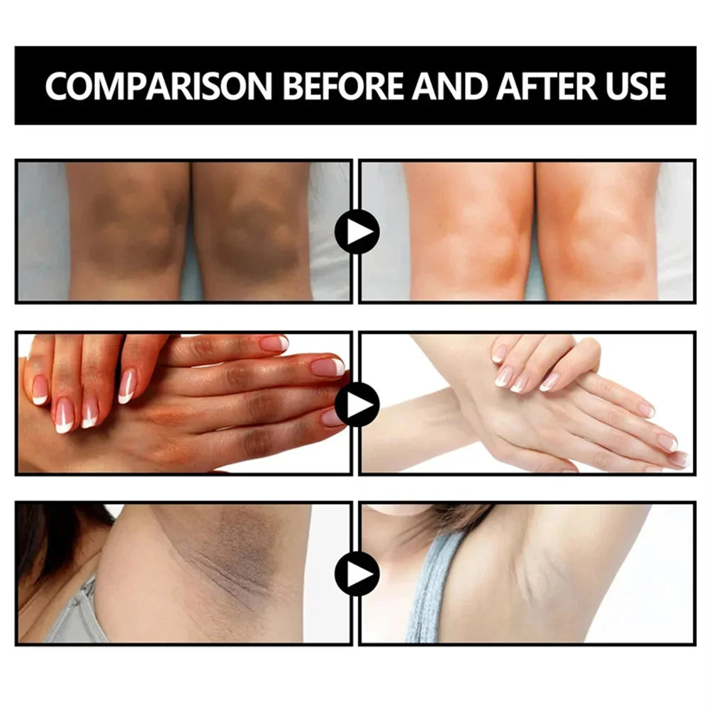 Body Whitening Soap Deep Clean Skin Chicken Skin Removal Soap Armpit Underarm Knees Bleaching Body Brighten White Care Products