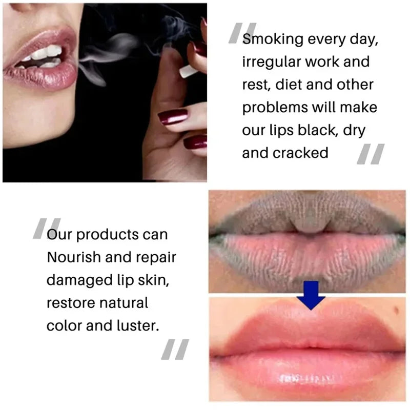 Remove Dark Aloe Lip Balm Lightening Melanin Mask Lip Gloss Oil  Exfoliating Clean Moisturizer Makeup Korean Beauty Products