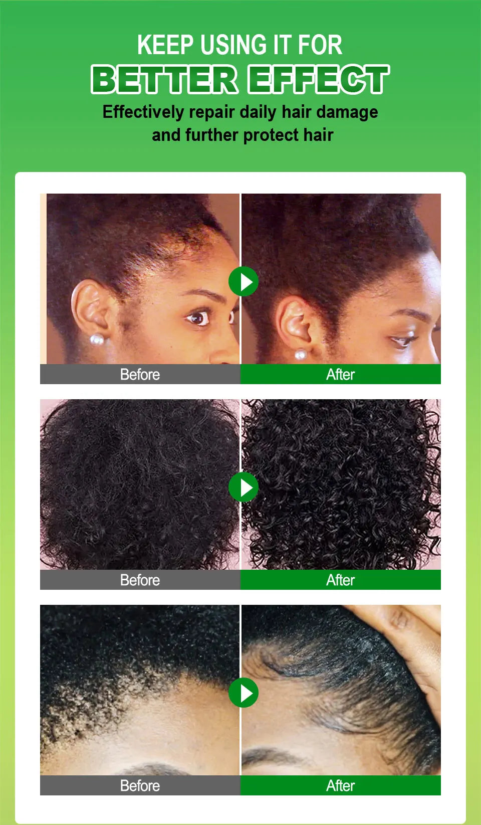 Sevich Chebe Hair Growth Serum Africa Traction Alopecia Chebe Anti Hair Loss Treatment Crazy Fast Hair Growing Oil Hair Care