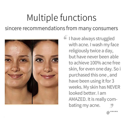 Turmeric Whitening Soap Original Skin Lightening Deep Cleaning Freckle Removal Ginger Handmade Soaps Oil Control Skin Care