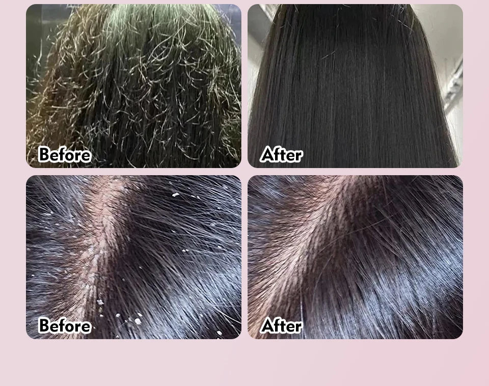 Natural 100% Pure Batana Oil For Hair Growth Butter Hair Mask Traction Alopecia Anti Hair Loss Baldness Treatment For Men Women