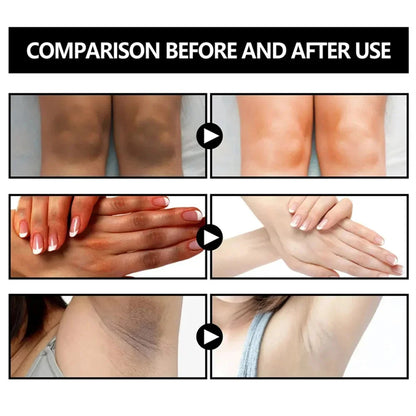 Body Whitening Soap Underarm Knee Bleaching Soap Chicken Skin Removal Dark Spot Removal Dead Skin Moisturize Brighten Body Care