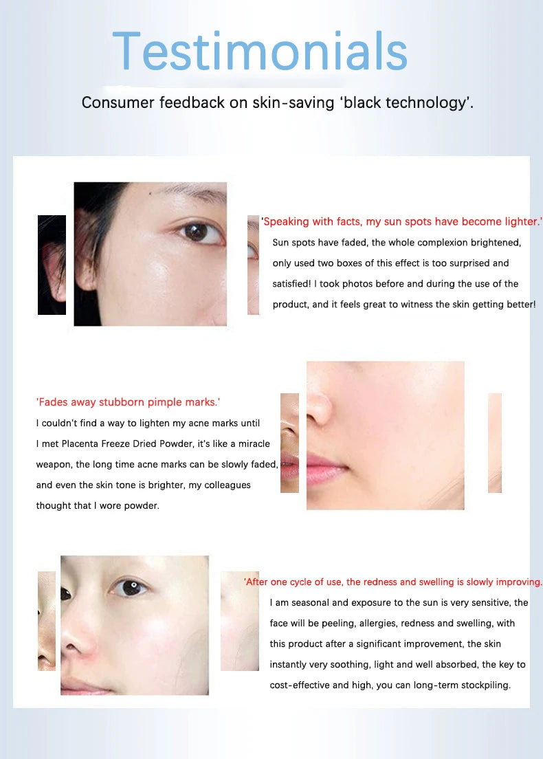Polypeptide Placenta Freeze-dried Powder Essence Repair Facial Hydrating Nourishing Pore Shrinking Skin Rejuvenate Skin Care