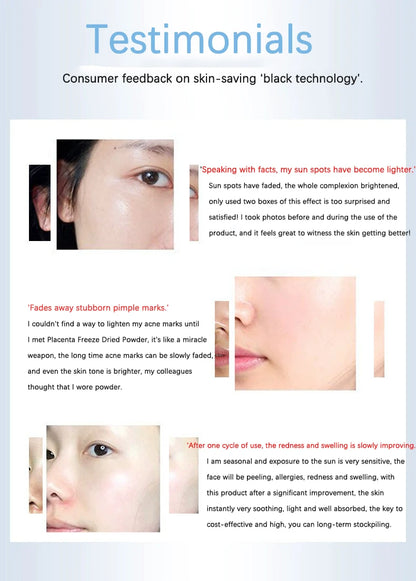 Polypeptide Placenta Freeze-dried Powder Essence Repair Facial Hydrating Nourishing Pore Shrinking Skin Rejuvenate Skin Care