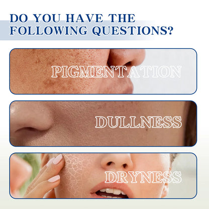 OUHOE Whitening face cream Moisturizes, brightens, lightens facial spots, moisturizes, tightens, smoothes and tender face cream