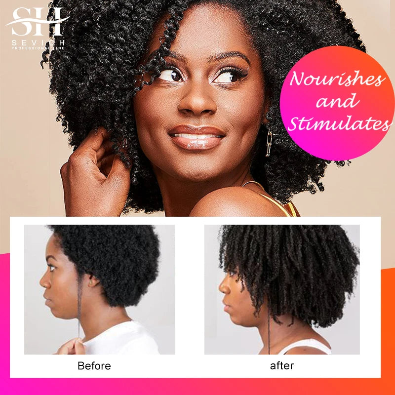 Sevich 100% Chebe Powder Effective Growthing Hair Improves Hair Density Nourishes Follicles Fast Regrowth Hair Product 100g