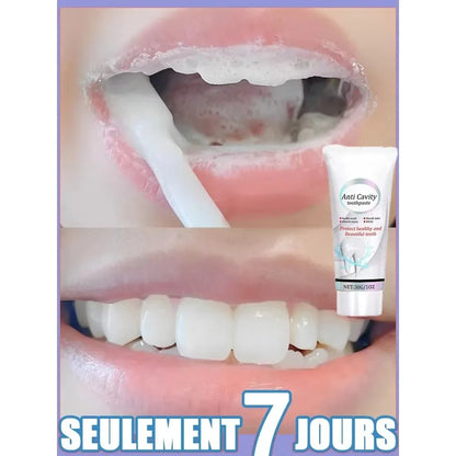 Dental Calculus Remover Bad Breath Removal Whitening Teeth Toothpaste Brightening Preventing Periodontitis Dental Cleansing