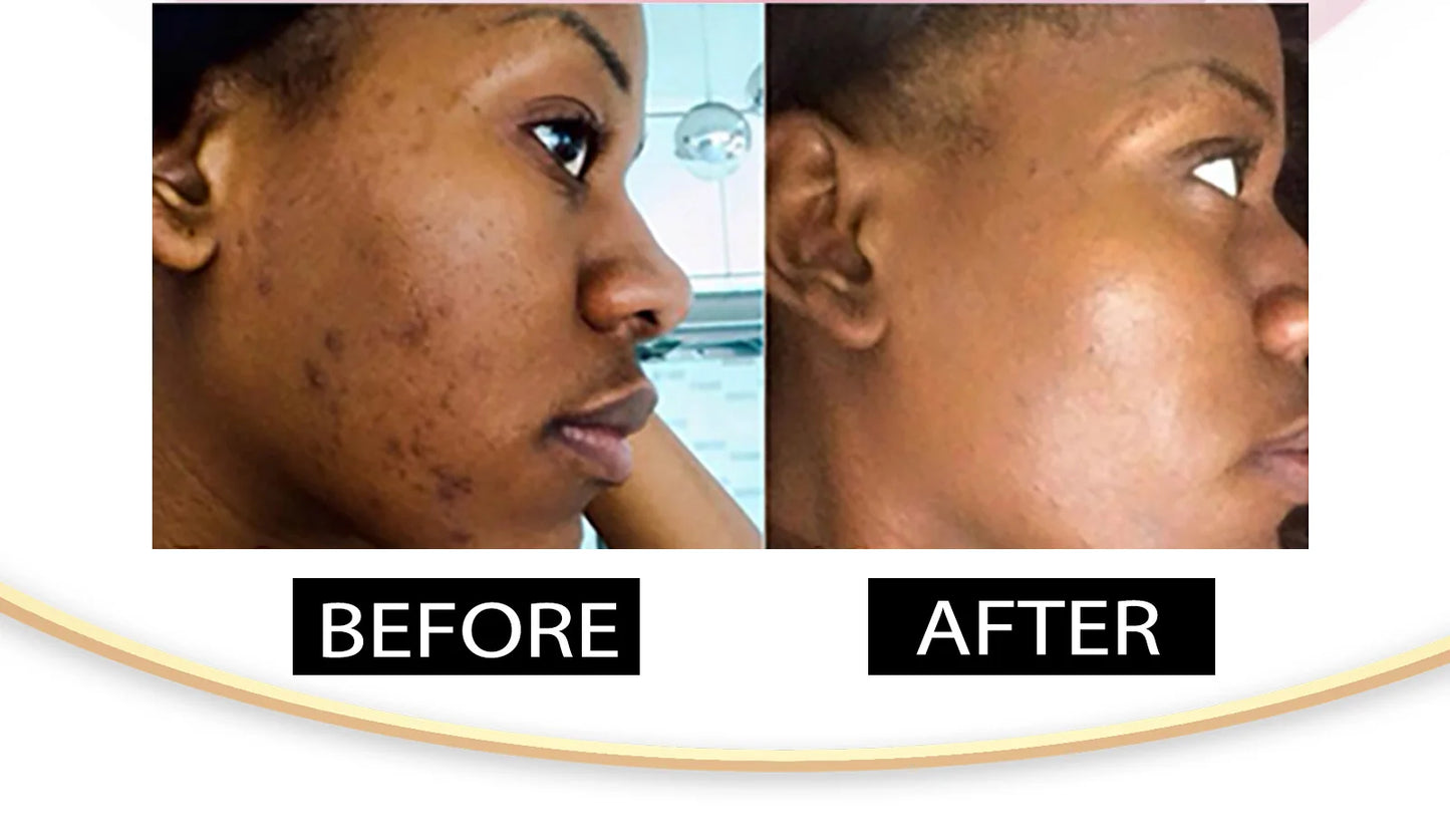 AILKE Collagen 5-in-1 Skin Care Set, Restore Skin Elasticity, Smooth Skin, Brighten, Even Skin Tone,For Face And Body Use Kit