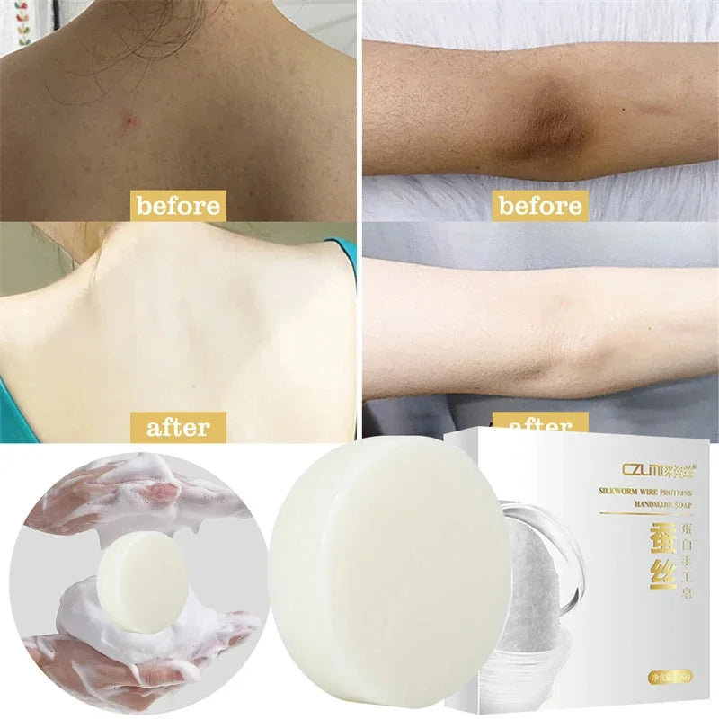 Body Whitening Soap Deep Clean Skin Chicken Skin Removal Soap Armpit Underarm Knees Bleaching Body Brighten White Care Products
