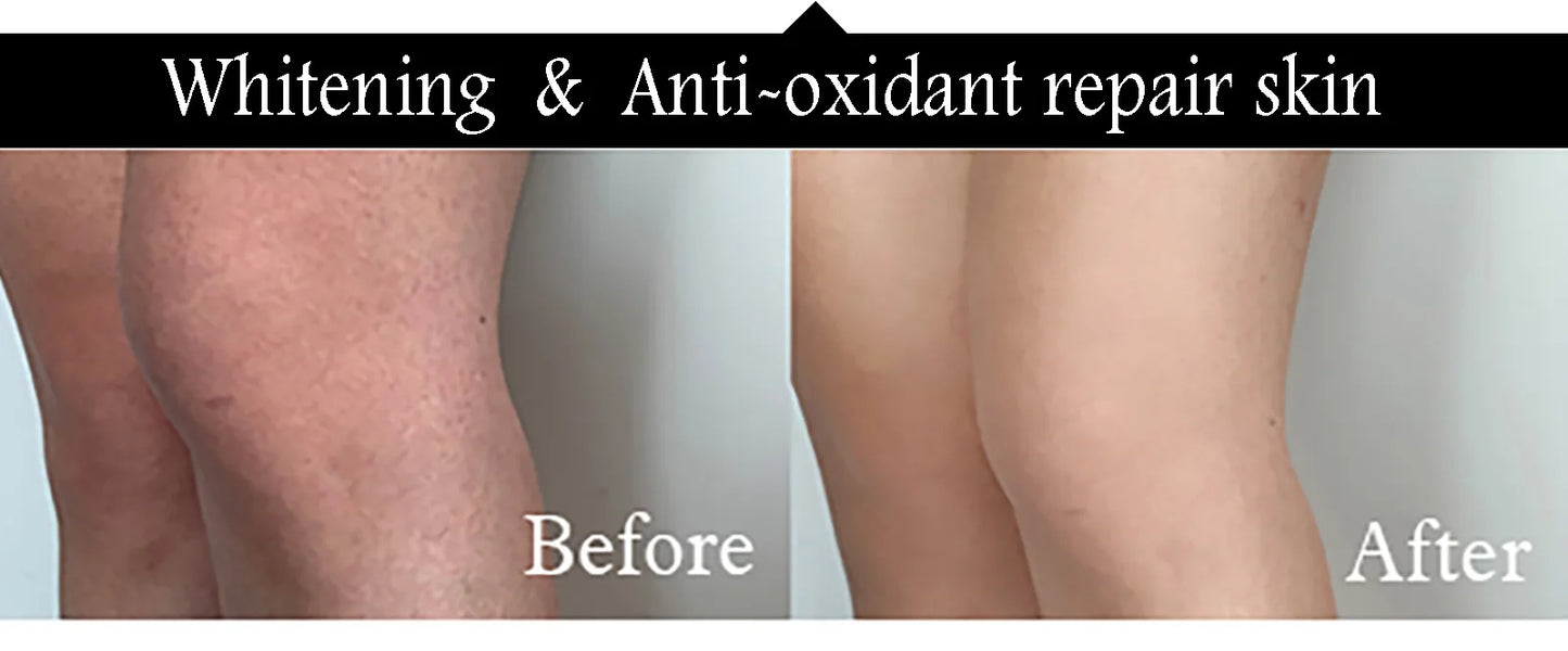 AILKE Collagen 5-in-1 Skin Care Set, Restore Skin Elasticity, Smooth Skin, Brighten, Even Skin Tone,For Face And Body Use Kit