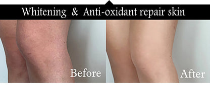 AILKE Collagen 5-in-1 Skin Care Set, Restore Skin Elasticity, Smooth Skin, Brighten, Even Skin Tone,For Face And Body Use Kit