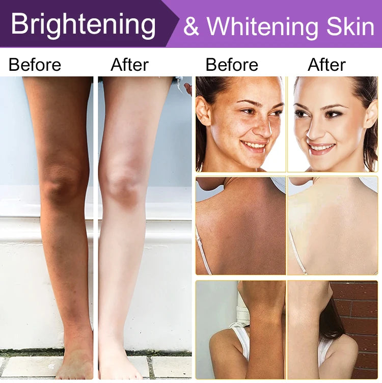 AILKE Premium Skin Lightening Cream - Dark Spot Corrector for Uneven Skin Tone - Face, Body, Underarm, Knees, Elbows, Knuckle