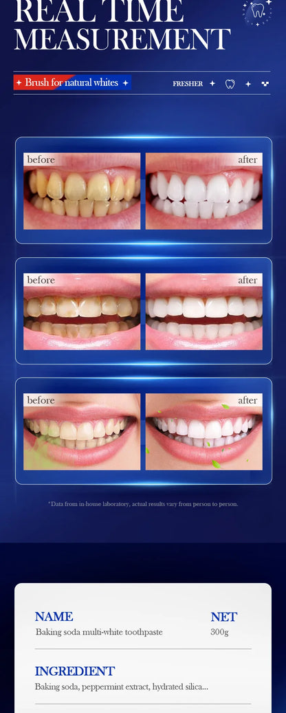 Baking Soda Probiotic Whitening Toothpaste To Remove Yellow Teeth Stains and White Teeth Removal Clean Teeth Fresh Mouth 300g