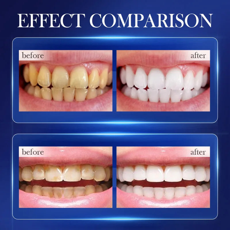 Baking Soda Probiotic Whitening Toothpaste To Remove Yellow Teeth Stains and White Teeth Removal Clean Teeth Fresh Mouth 300g