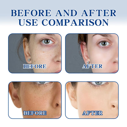 OUHOE Whitening face cream Moisturizes, brightens, lightens facial spots, moisturizes, tightens, smoothes and tender face cream