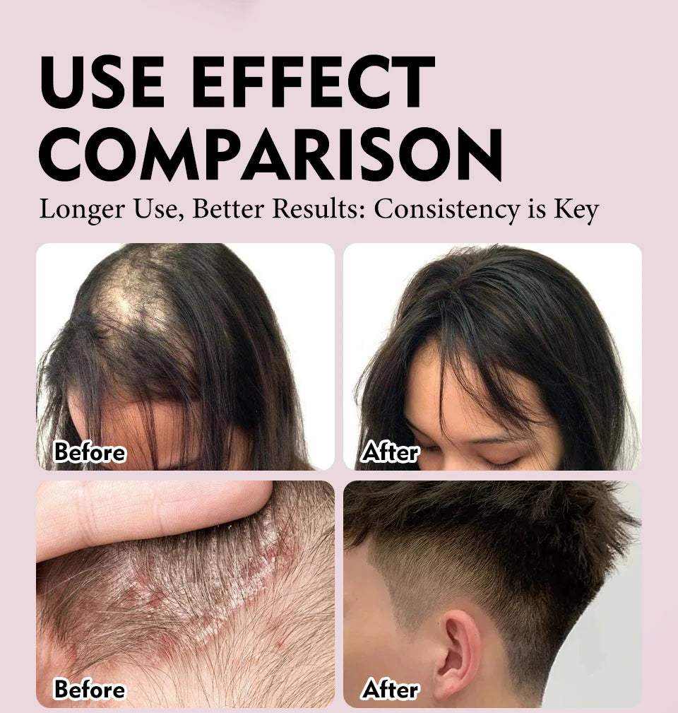 Natural 100% Pure Batana Oil For Hair Growth Butter Hair Mask Traction Alopecia Anti Hair Loss Baldness Treatment For Men Women