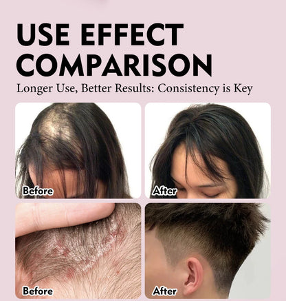 Natural 100% Pure Batana Oil For Hair Growth Butter Hair Mask Traction Alopecia Anti Hair Loss Baldness Treatment For Men Women