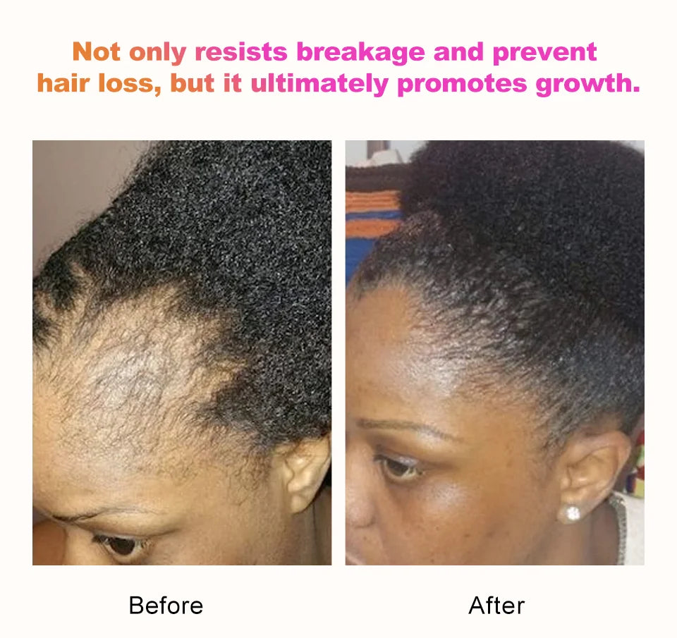 Sevich 100% Chebe Powder Effective Growthing Hair Improves Hair Density Nourishes Follicles Fast Regrowth Hair Product 100g