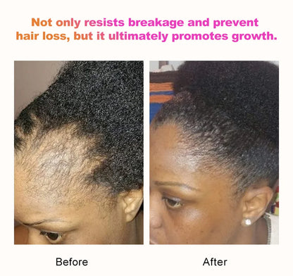 Sevich 100% Chebe Powder Effective Growthing Hair Improves Hair Density Nourishes Follicles Fast Regrowth Hair Product 100g