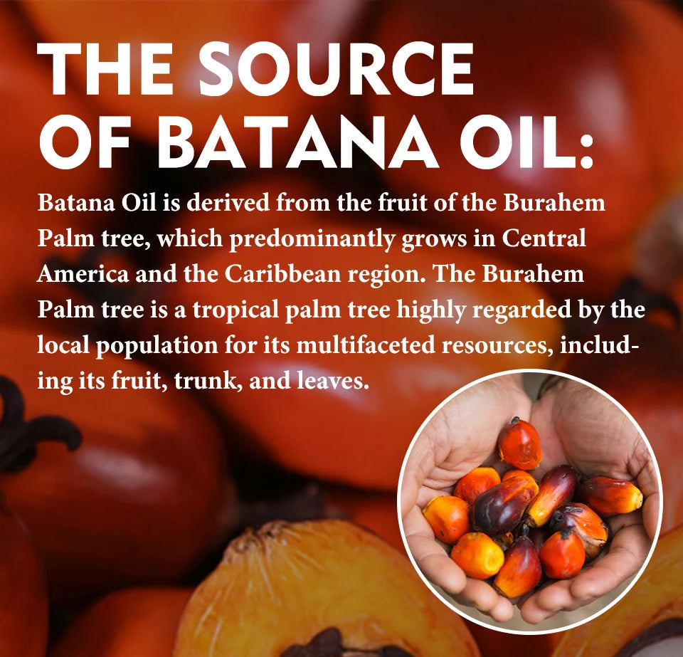 Natural 100% Pure Batana Oil For Hair Growth Butter Hair Mask Traction Alopecia Anti Hair Loss Baldness Treatment For Men Women