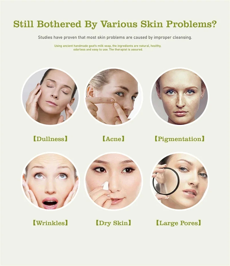 Body Whitening Soap Underarm Knee Bleaching Soap Chicken Skin Removal Dark Spot Removal Dead Skin Moisturize Brighten Body Care