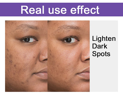 AILKE Premium Skin Lightening Cream - Dark Spot Corrector for Uneven Skin Tone - Face, Body, Underarm, Knees, Elbows, Knuckle