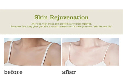 Body Whitening Soap Deep Clean Skin Chicken Skin Removal Soap Armpit Underarm Knees Bleaching Body Brighten White Care Products