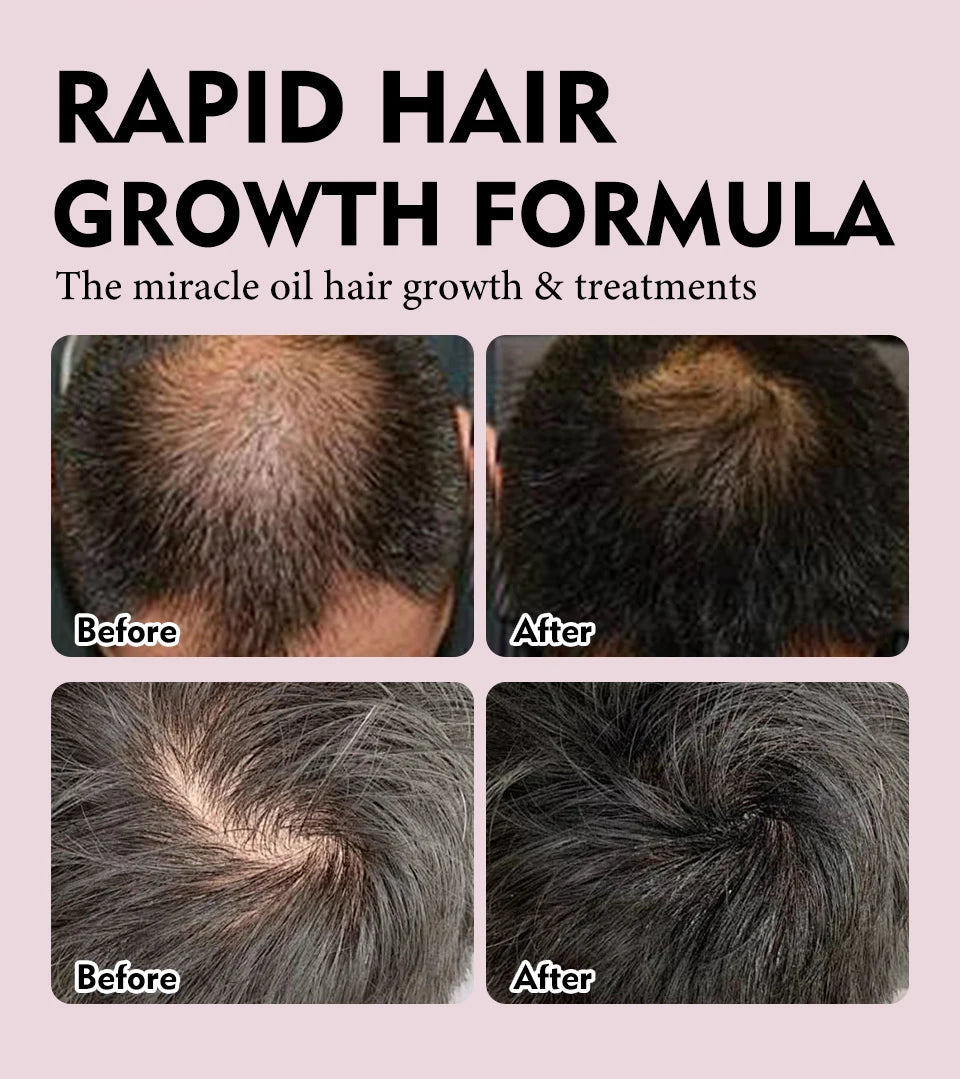 Natural 100% Pure Batana Oil For Hair Growth Butter Hair Mask Traction Alopecia Anti Hair Loss Baldness Treatment For Men Women