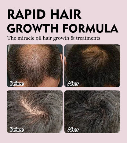 Natural 100% Pure Batana Oil For Hair Growth Butter Hair Mask Traction Alopecia Anti Hair Loss Baldness Treatment For Men Women