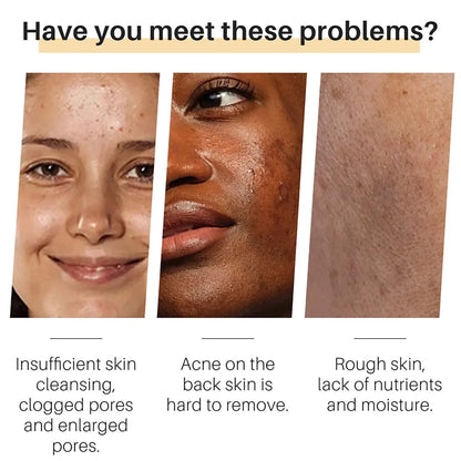 Turmeric Whitening Soap Original Skin Lightening Deep Cleaning Freckle Removal Ginger Handmade Soaps Oil Control Skin Care