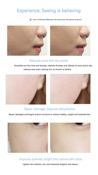 Polypeptide Placenta Freeze-dried Powder Essence Repair Facial Hydrating Nourishing Pore Shrinking Skin Rejuvenate Skin Care