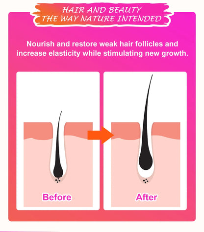 Sevich 100% Chebe Powder Effective Growthing Hair Improves Hair Density Nourishes Follicles Fast Regrowth Hair Product 100g